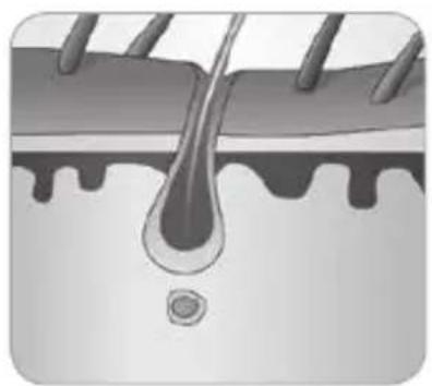 BABYLISS Homelight G930E - - Como é que a luz elimina os pêlos? - 6