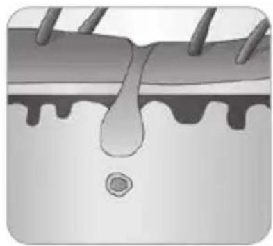 BABYLISS Homelight G930E - How does the light eliminate hair? - 6