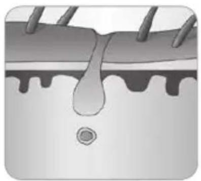 BABYLISS Homelight G930E - - Como é que a luz elimina os pêlos? - 7
