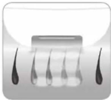 BABYLISS Homelight G930E - ¿Cómo logra la luz eliminar el vello? - 2