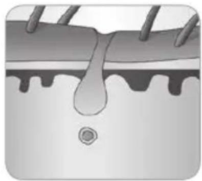 BABYLISS Homelight G930E - ¿Cómo logra la luz eliminar el vello? - 6