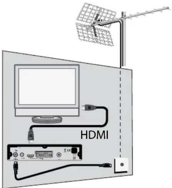 METRONIC Zapbox EHD2 441622 - A-Installazione amplificata - 1