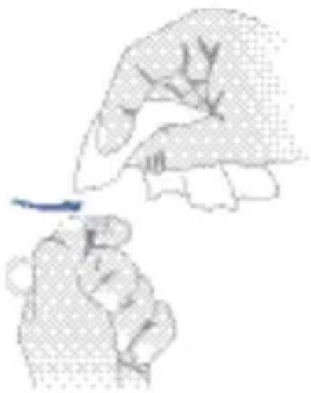 SIEMENS Pure Carat - Cleaning ear pieces - 1