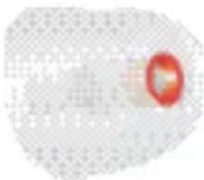 SIEMENS Pure Carat - Attention - 7