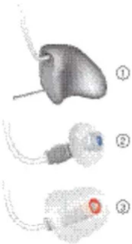 SIEMENS Pure Carat - Ohre RIC Horsysteme - 8