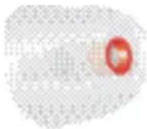SIEMENS Pure Carat - OPGELET - 7