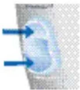 SIEMENS Lotus BTE - Volumeregelaar - 2