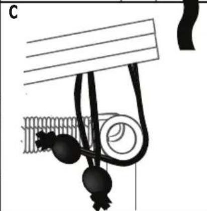 EXIT Supreme Allin1 - STEP 5 - 5