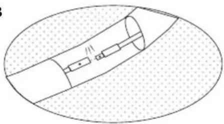 EXIT Supreme Allin1 - B - 2