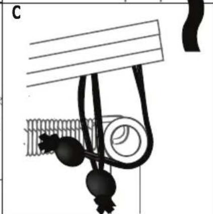 EXIT Supreme Allin1 - ETAPE5 - 5