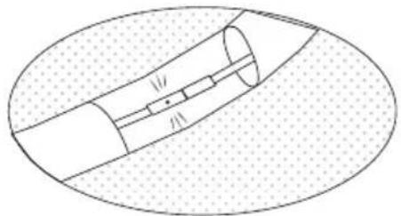 EXIT Supreme Allin1 - B - 3