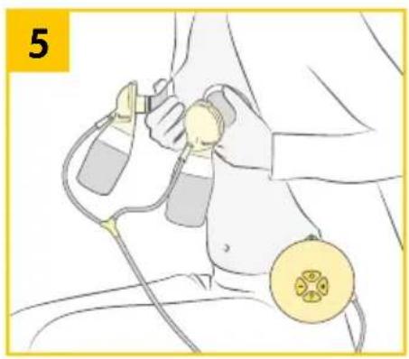 MEDELA Swing Maxi - Swing Maxi Flex - Preparing for double pumping - 7
