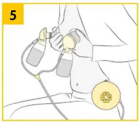 MEDELA Swing Maxi - Swing Maxi Flex - Voorbereiding voor dubbel afkolen - 7