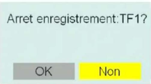 TRIAX TR 63 - ànregistrement direct - 3