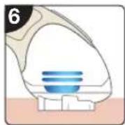 RIO IPL Pro - Remarques : - 1