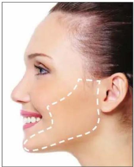 RIO IPL Pro - GEZICHTSBEHANDELING - 1