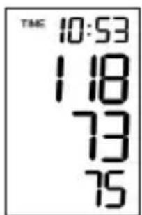 Marque Verte Digitensio BP 3BQ13 - Procedure de mesure - 4
