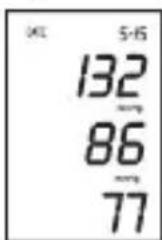 Marque Verte Digitensio BP 3BQ13 - Mise en mémoire des 60 dernières mesures - 2