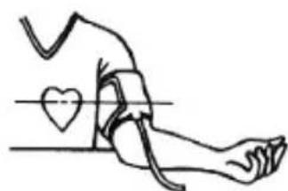 Marque Verte Digitensio BP 3BM13P - Remarque: - 1