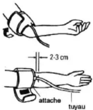 Marque Verte Digitensio BP 3BM13P - Mise en place du brassard - 1