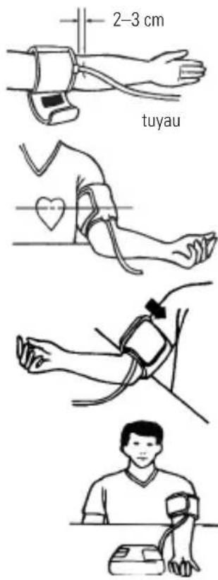 Marque Verte Digitensio BP 3BM13P - De manchet passen - 2