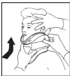 Laerdal Stifneck Collier cervical - Placer la minerve sur le patient tout en lui maintainant la tete en position neutre - 1