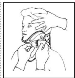 Laerdal Stifneck Collier cervical - Placer la minerve sur le patient tout en lui maintainant la tete en position neutre - 2
