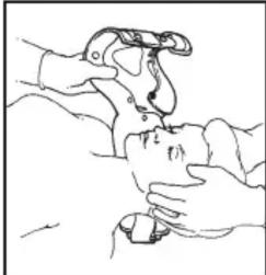 Laerdal Stifneck Collier cervical - Placer la minerve sur le patient tout en lui maintainant la tete en position neutre - 3