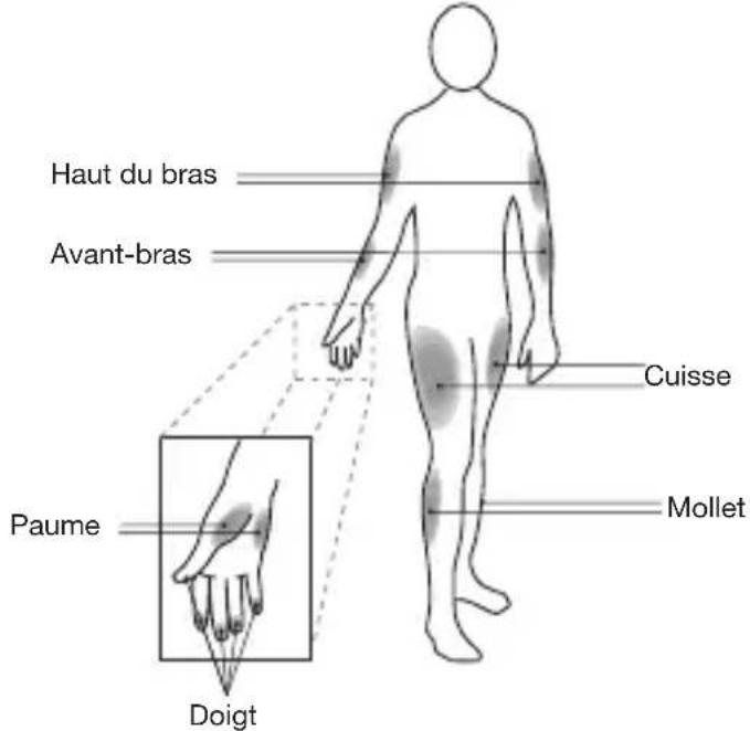 IHEALTH Align - PRÉLEVEMENT DE SANG SUR UN SITE ALTERNATIF - 1