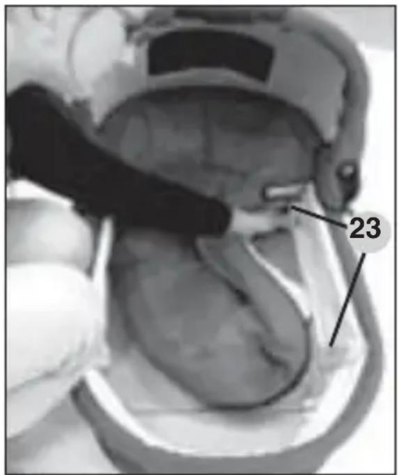 HARTAN VIP GT - Portage et piège du couffin pliable - 3