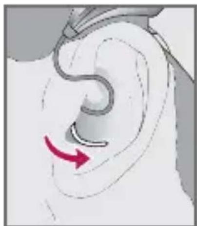 Starkey Halo - Insertion - 3