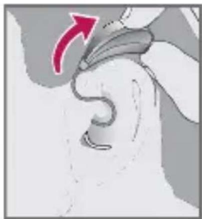 Starkey Halo - Insertion - 2