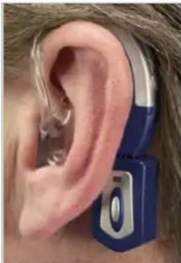Starkey DaVinci - Utilisation du téléphone - 4