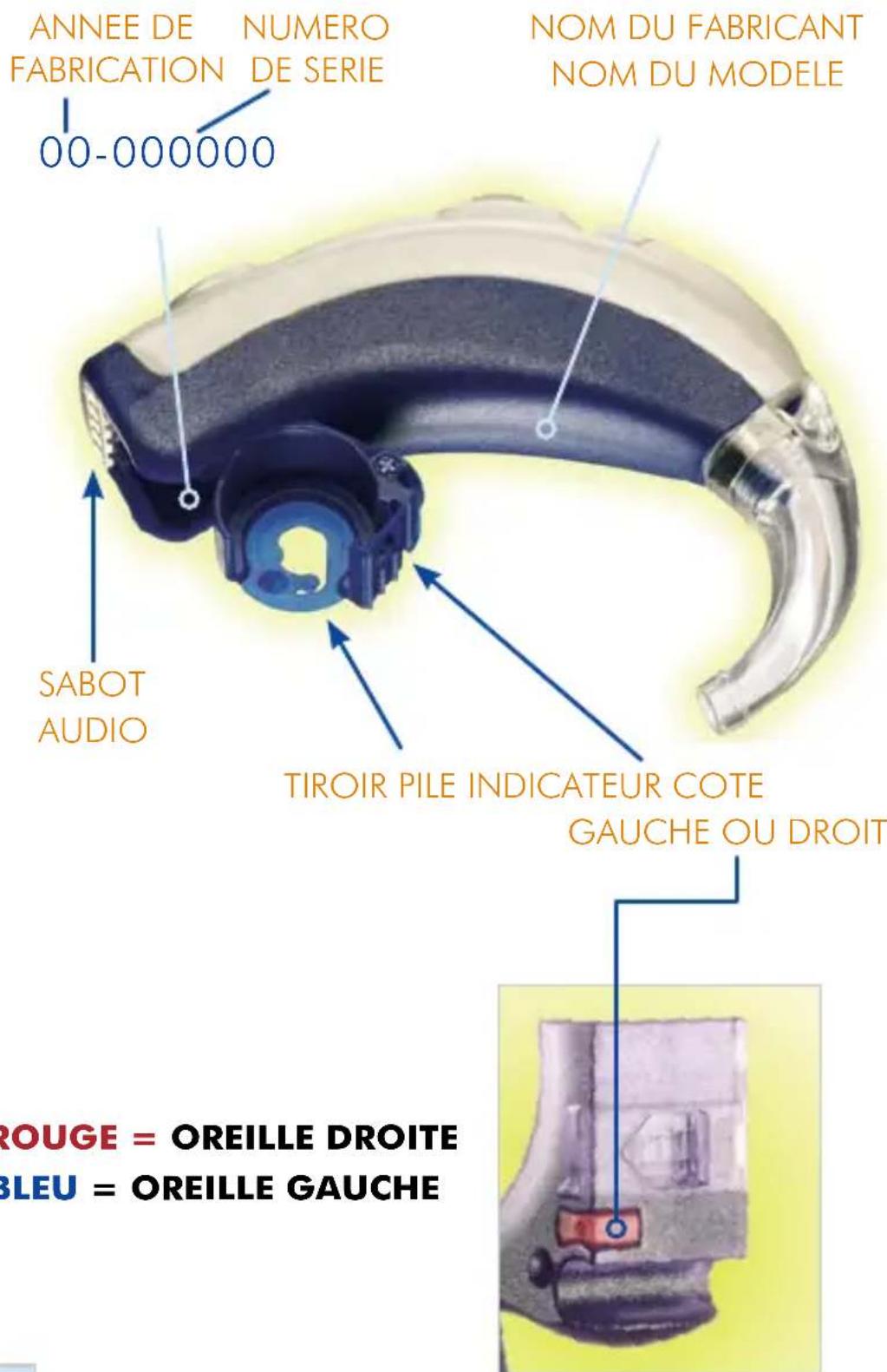 Starkey DaVinci - Identification - 1