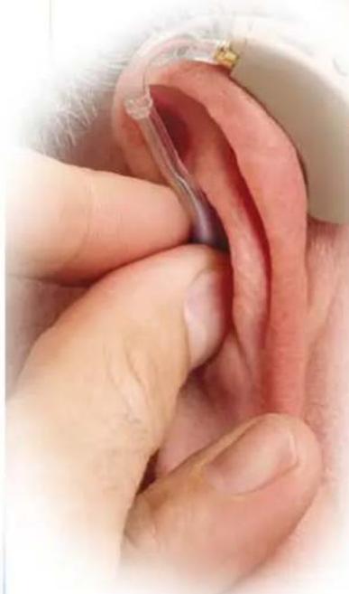 Starkey Axent - Insertion et Extraction - 3