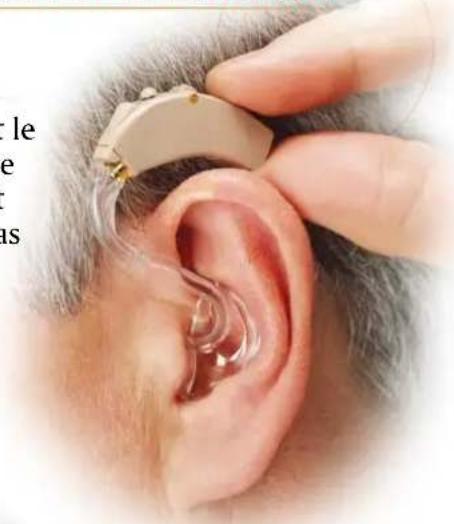 Starkey Axent - Insertion et Extraction - 2