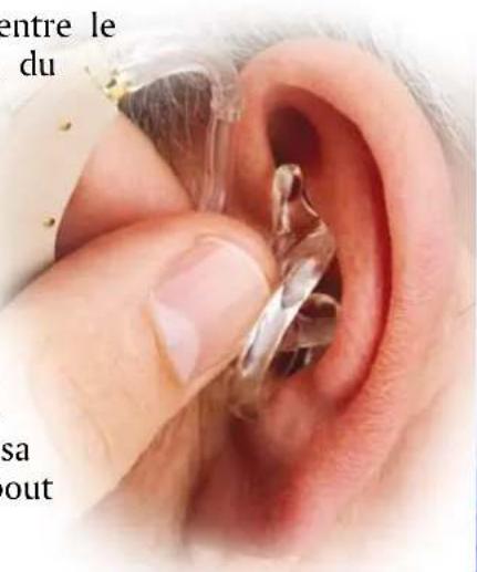 Starkey Axent - INSERTION - 1