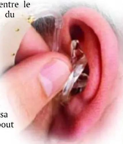 Starkey Arista - INSERTION - 1