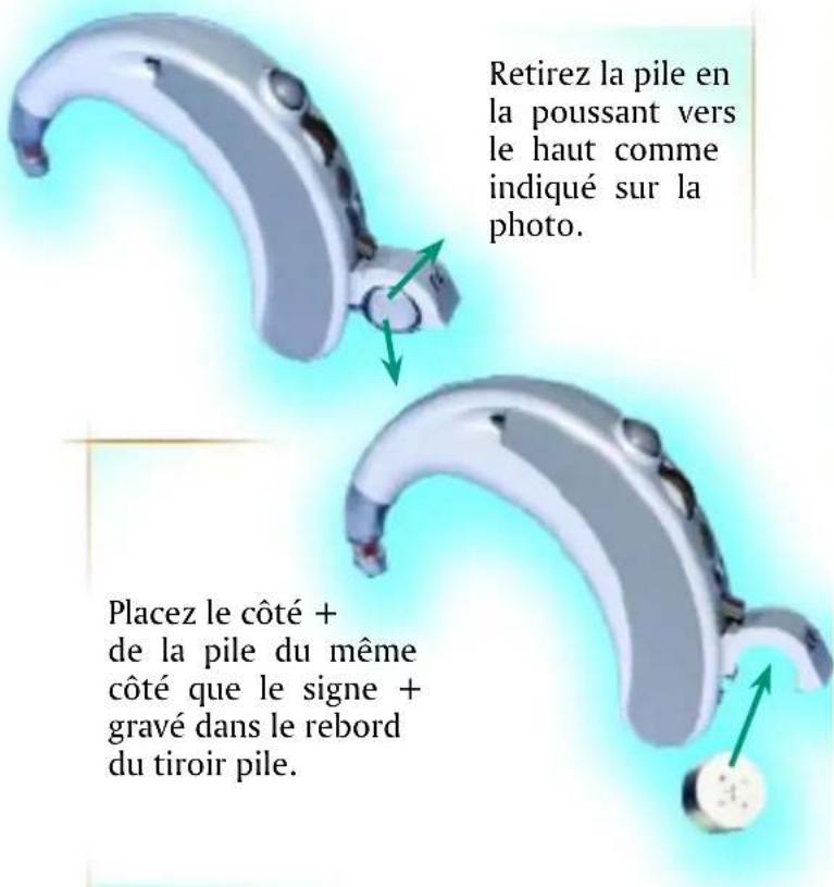 Starkey Arista - votre aide auditive - 1