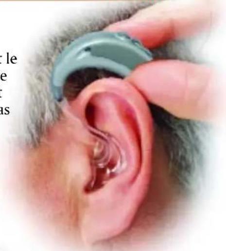 Starkey Arista - Insertion et Extraction - 2