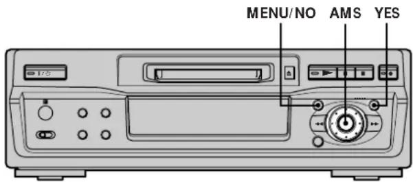 SONY MDSS41 - Consejos para la grabación de minidiscos en cinta - 1