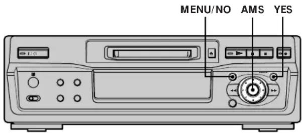 SONY MDSS41 - Conseils pour l'enregistrement à partir de MD sur une cassette - 1