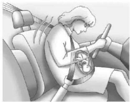 CHEVROLET Cruze (2018) - Utilisationdeceinturedesecuritépendantlgrossesse - 1