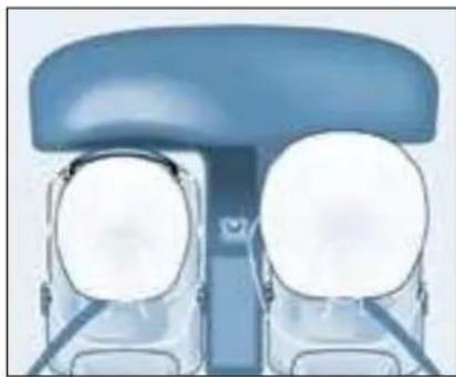 PEUGEOT 206 CC (2004) - LES AIRBAGS - 1