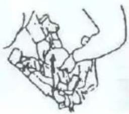 Topmark Charlie T7034 - ZUSAMMENKLAPPEN - 2