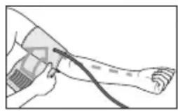 SANITAS SBM 37 - Attaching the cuff - 2