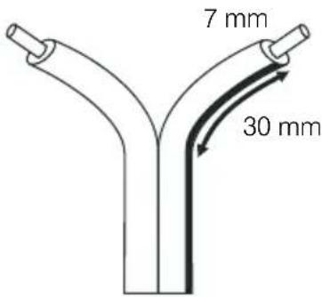 Q-ACOUSTICS 3020i - Vorbereitung der Kabel - 1
