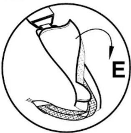 Life & Mobility NewBug - FIXING THE STRAP ON THE BOTTOM OF THE SEAT - 5