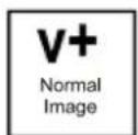 EAL APR035 - MENUKnop - 2