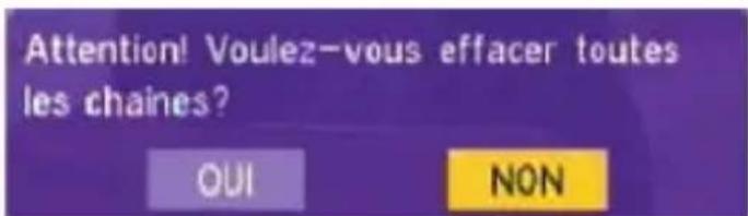 VISIONIC VNT 200 - Faire toutes les façades - 4